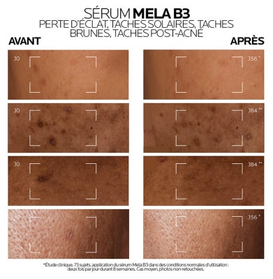La Roche-Posay Mela B3 Sérum Concentré Anti-Taches 30 ml